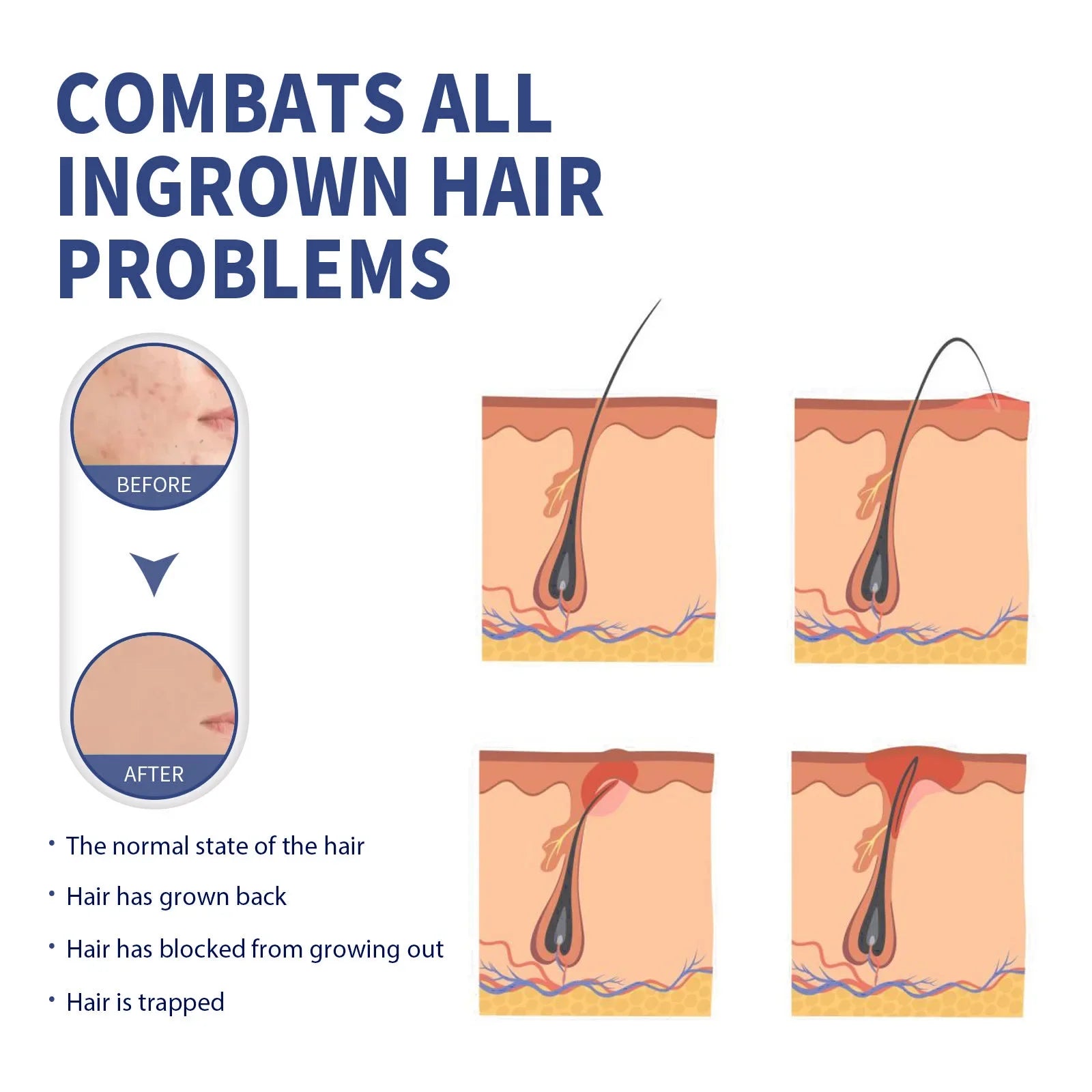 Crème à raser spéciale lisse